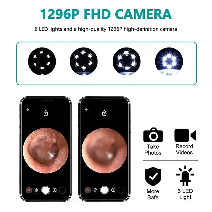 Cléo™ – Nettoyeur d'Oreilles Visuel Intelligent 🇬🇦