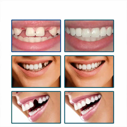 Kit de Dents Ajustables – Sourire Confiant Instantané 🇲🇱